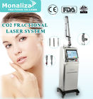 Vaginal Tightening CO2 Fractional Laser Machine 800VA Acne Treatment Device 47kg