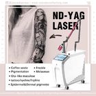 Skin Rejuvenation Q Switched ND Yag Laser System Minimal recovery